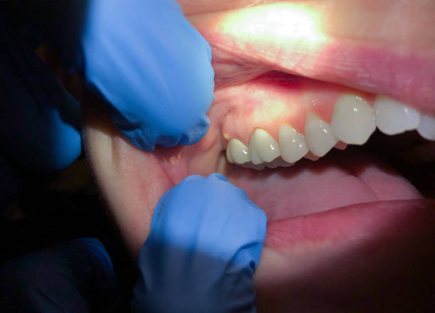 Best Emergency Treatment for Toothache in Charleston, WV